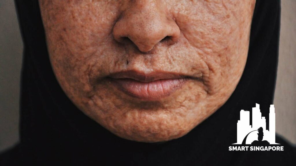 Best Clinics for Your Acne