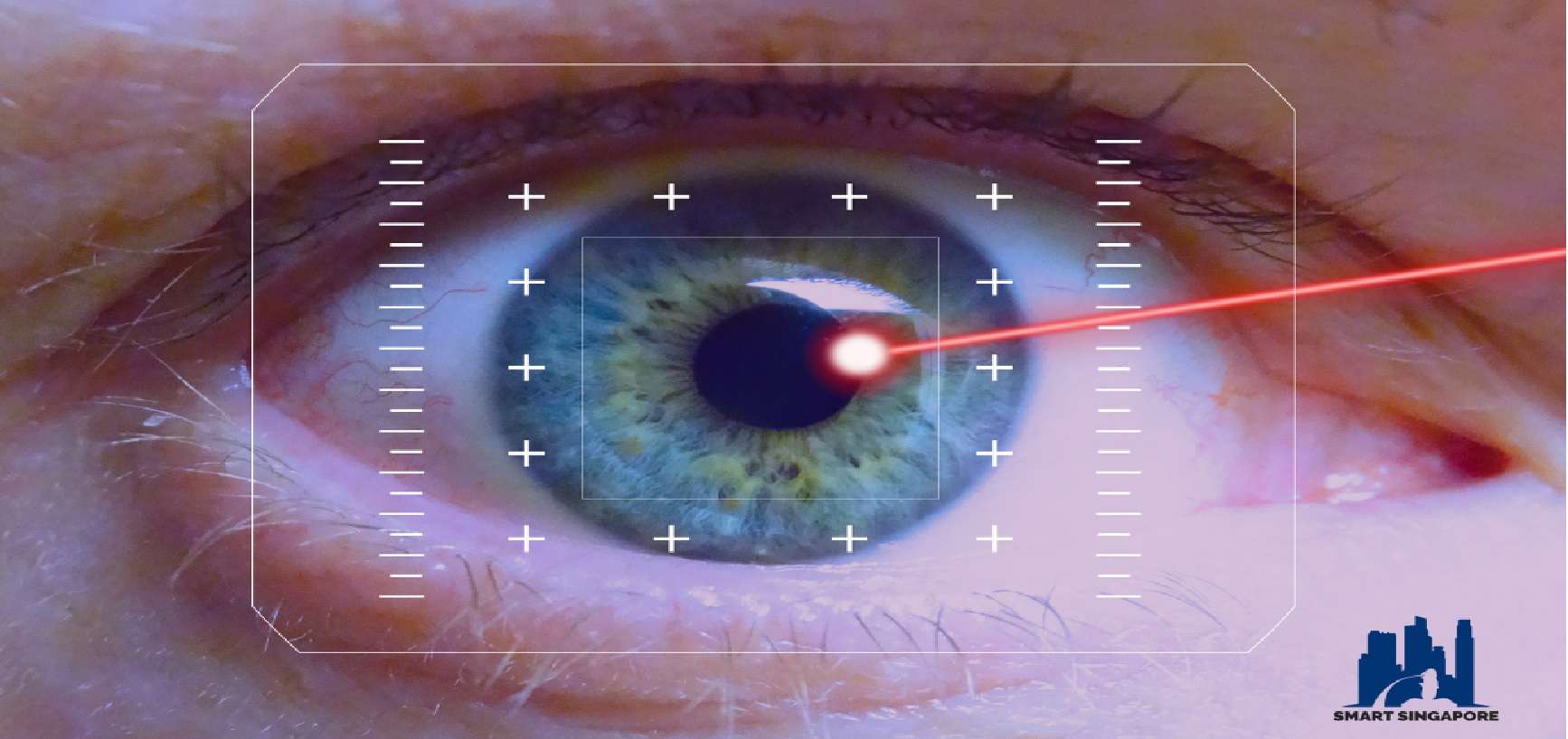 Eye Centres