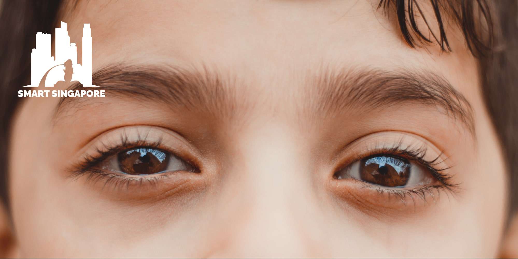 Top 5 Clinics for Ptosis Surgery in Singapore