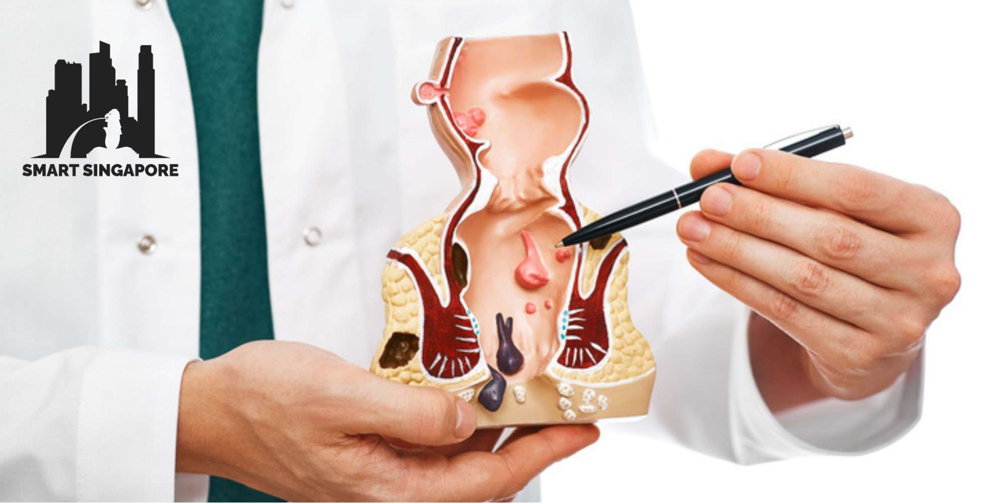 Top 5 Colon Doctors in Singapore