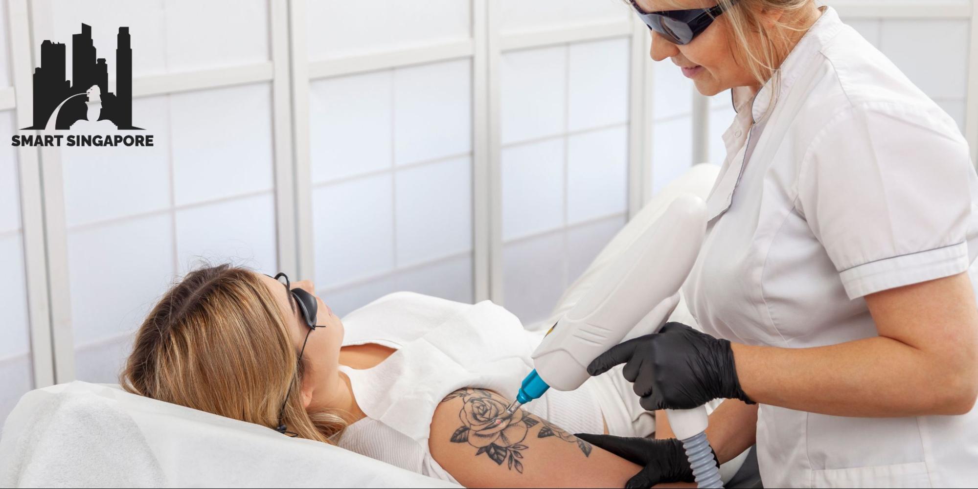 Tattoo Removal in Singapore: Say Goodbye to Unwanted Ink!