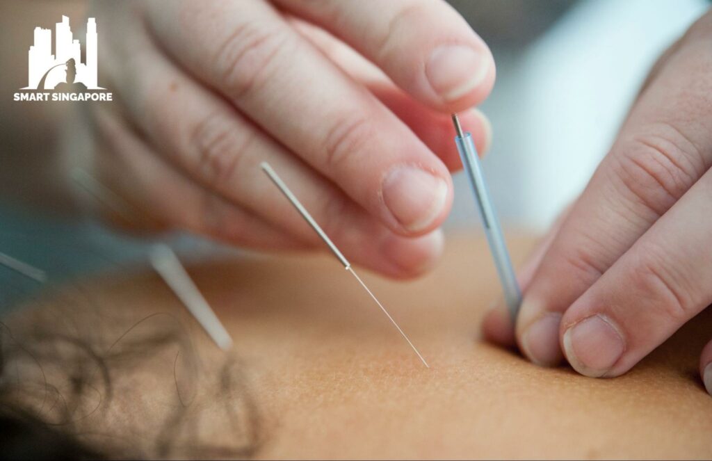 Top 5 Acupuncture Clinics in Singapore's Homepage
